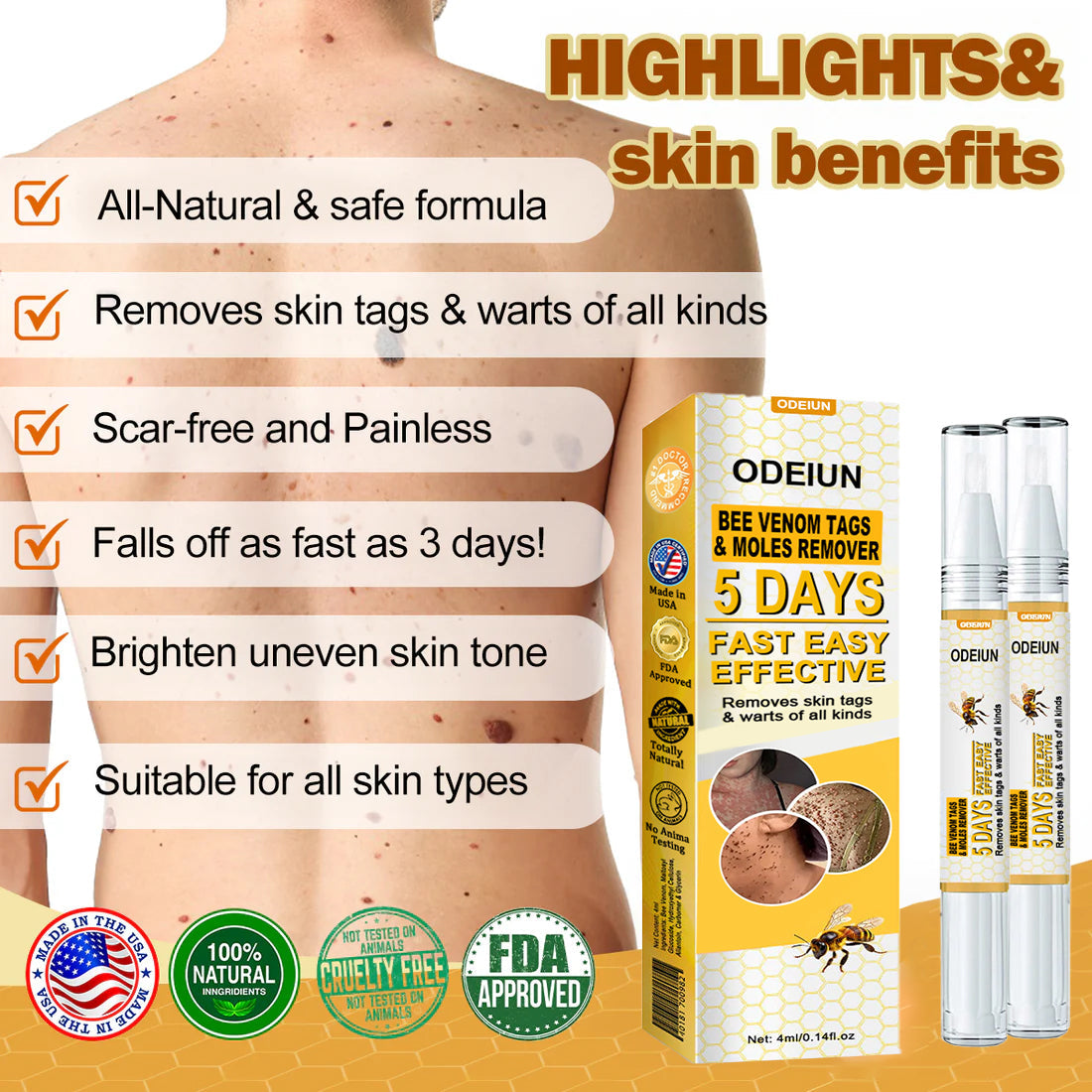 🌿🌿[✨𝐎𝐟𝐟𝐢𝐜𝐢𝐚𝐥 𝐁𝐫𝐚𝐧𝐝 𝐒𝐭𝐨𝐫𝐞✨] ODEIUN™ Bee Venom Tags & Moles Remover(👨‍⚕𝐀𝐀𝐃 𝐑𝐄𝐂𝐎𝐌𝐌𝐄𝐍𝐃𝐒)