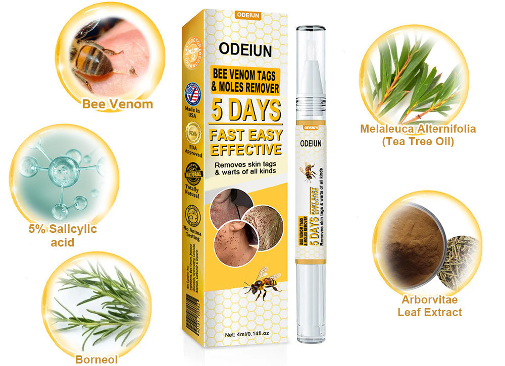 🌿🌿[✨𝐎𝐟𝐟𝐢𝐜𝐢𝐚𝐥 𝐁𝐫𝐚𝐧𝐝 𝐒𝐭𝐨𝐫𝐞✨] ODEIUN™ Bee Venom Tags & Moles Remover(👨‍⚕𝐀𝐀𝐃 𝐑𝐄𝐂𝐎𝐌𝐌𝐄𝐍𝐃𝐒)