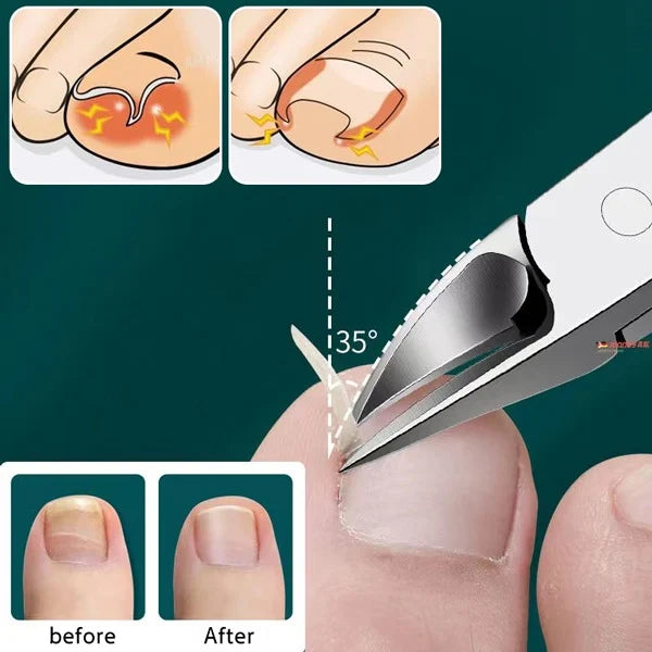 🔥Last Day 50% OFF🔥Professional Nail Clipper