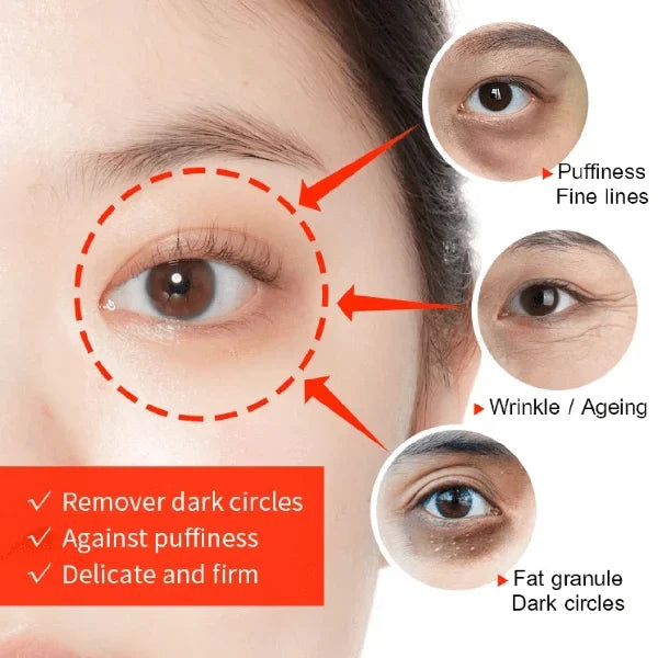 🔥Dark Circles Reducing Eye Cream