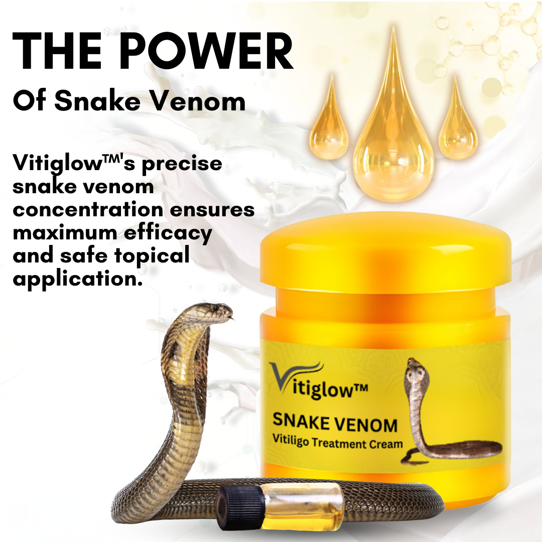 Vitiglow™ Snake Venom Vitiligo Treatment Cream - 👩‍⚕️ Recommended by Experts! 🔥 30-Days Money-Back Guarantee! 💰