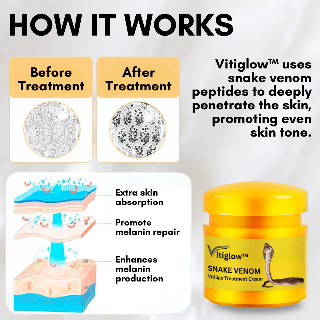 Vitiglow™ Snake Venom Vitiligo Treatment Cream - 👩‍⚕️ Recommended by Experts! 🔥 30-Days Money-Back Guarantee! 💰