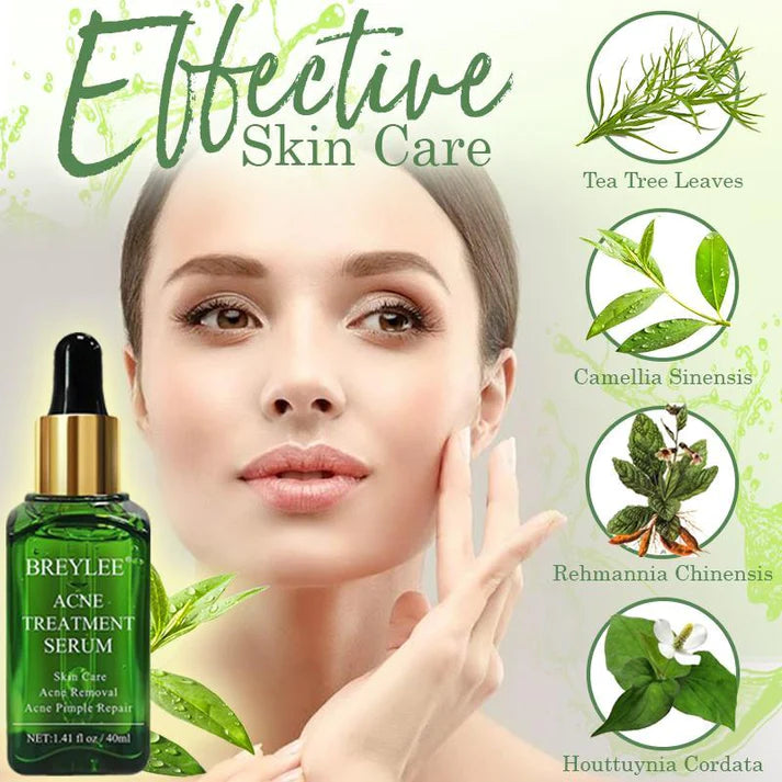 AcneAway Tea Tree Acne Serum