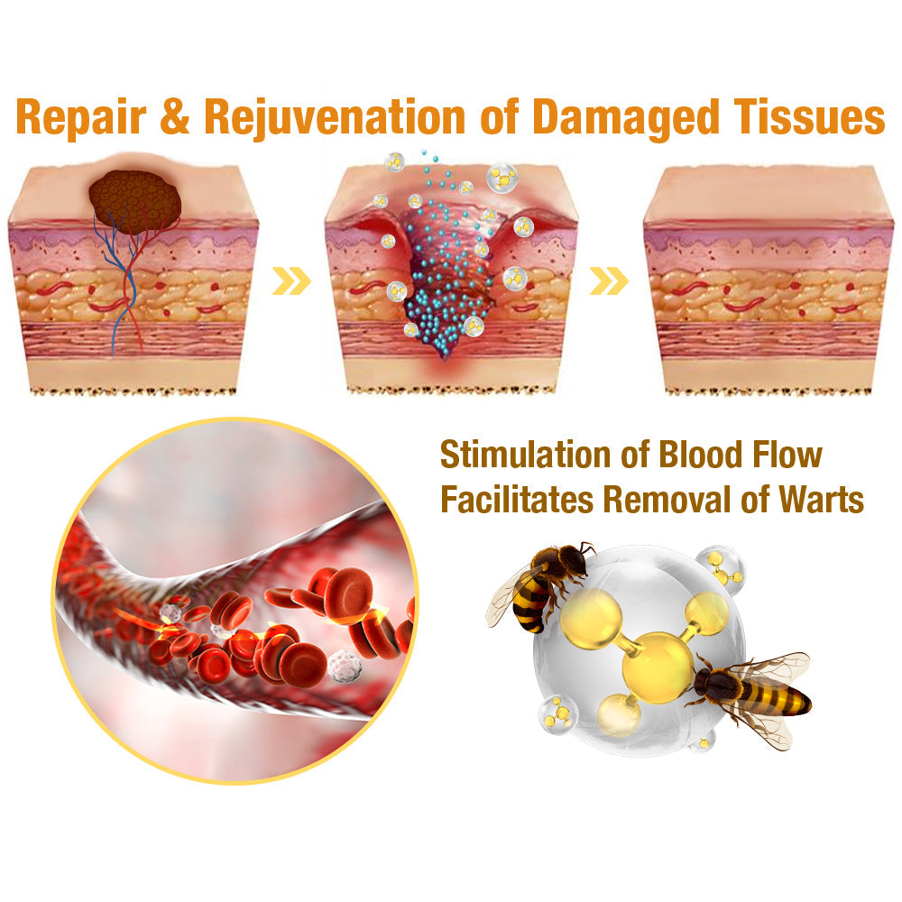 🌿🌿[✨𝐎𝐟𝐟𝐢𝐜𝐢𝐚𝐥 𝐁𝐫𝐚𝐧𝐝 𝐒𝐭𝐨𝐫𝐞✨] ODEIUN™ Bee Venom Tags & Moles Remover(👨‍⚕𝐀𝐀𝐃 𝐑𝐄𝐂𝐎𝐌𝐌𝐄𝐍𝐃𝐒)