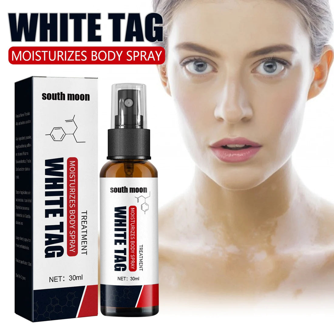 🔥Hot Sale - 49% OFF🎁 South Moon Vitiligo Relief Spray