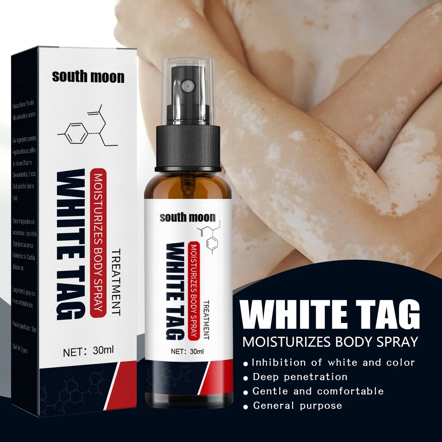 🔥Hot Sale - 49% OFF🎁 South Moon Vitiligo Relief Spray