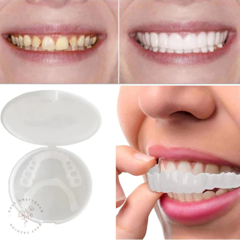 DenSure™ - Denture Braces