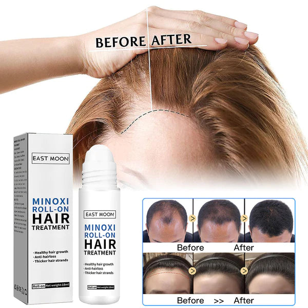 MINOXIDIL Roller Thick Hair Essential Oil🔥HOT SALE-49%OFF🔥