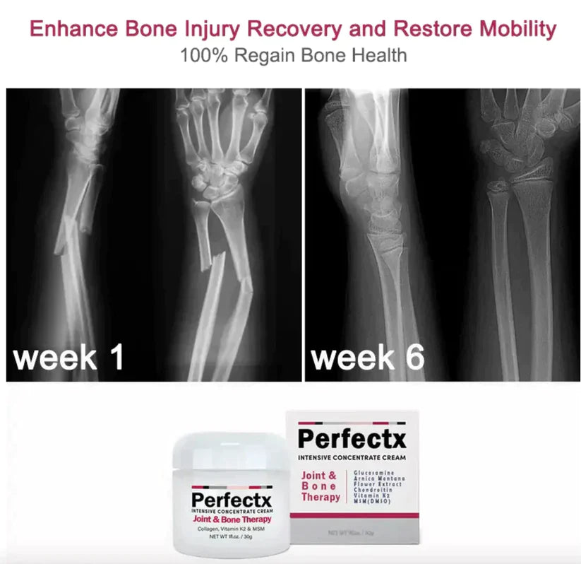 GFOUK™ Perfectx Joint and Bone Treatment Cream