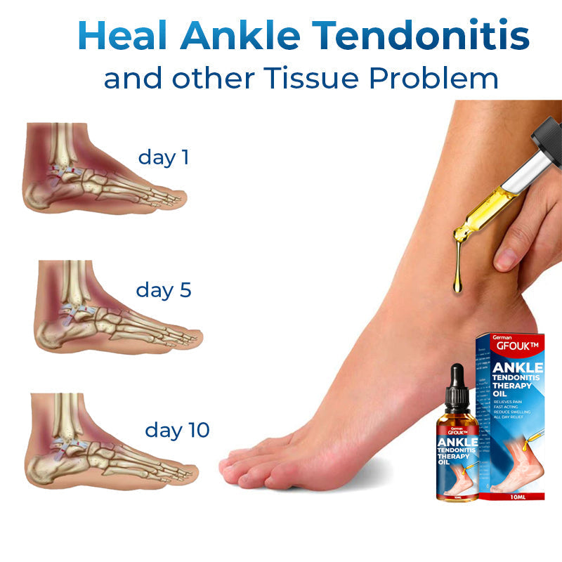 GFOUK™ German Ankle Tendonitis Therapy Oil