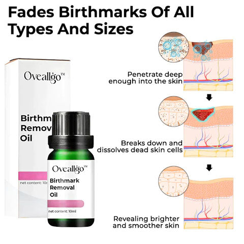 🔥LAST DAY Promotion 45% OFF🔥Oveallgo™ Birthmark Removal Oil