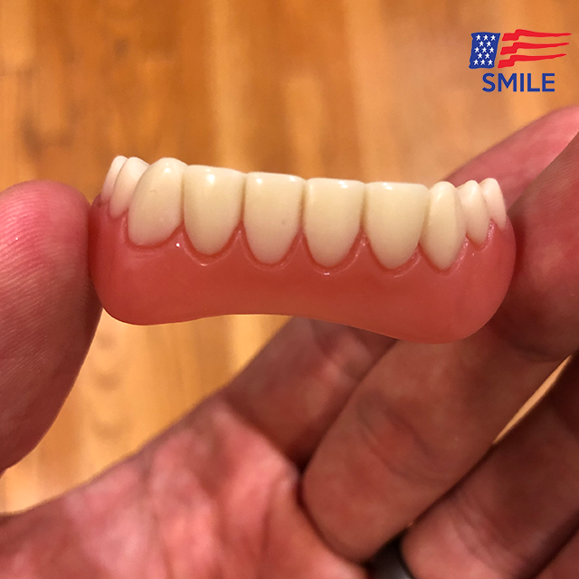 🔥Last Day 50% OFF🔥American Smile Veneers