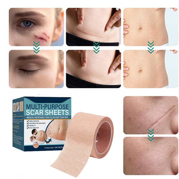 ELAIMEI™ Medical Soft Silicone Gel Tape for Scar Removal