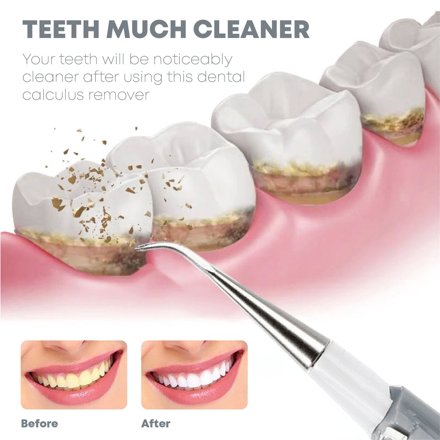 TeethWhitener Ultrasonic Vibration Cleaner