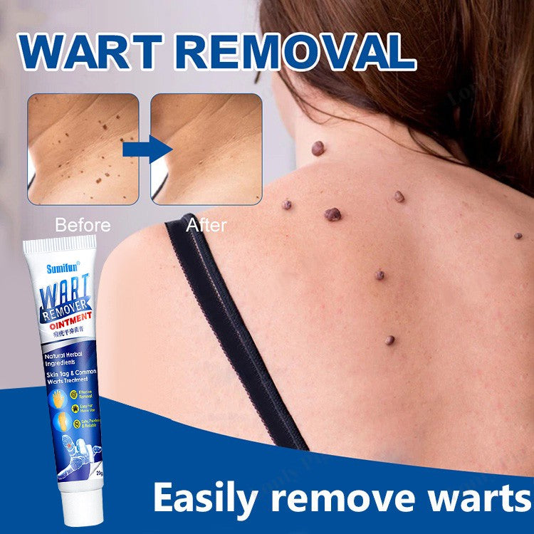 WartsOff Instant Blemish Treatment Cream