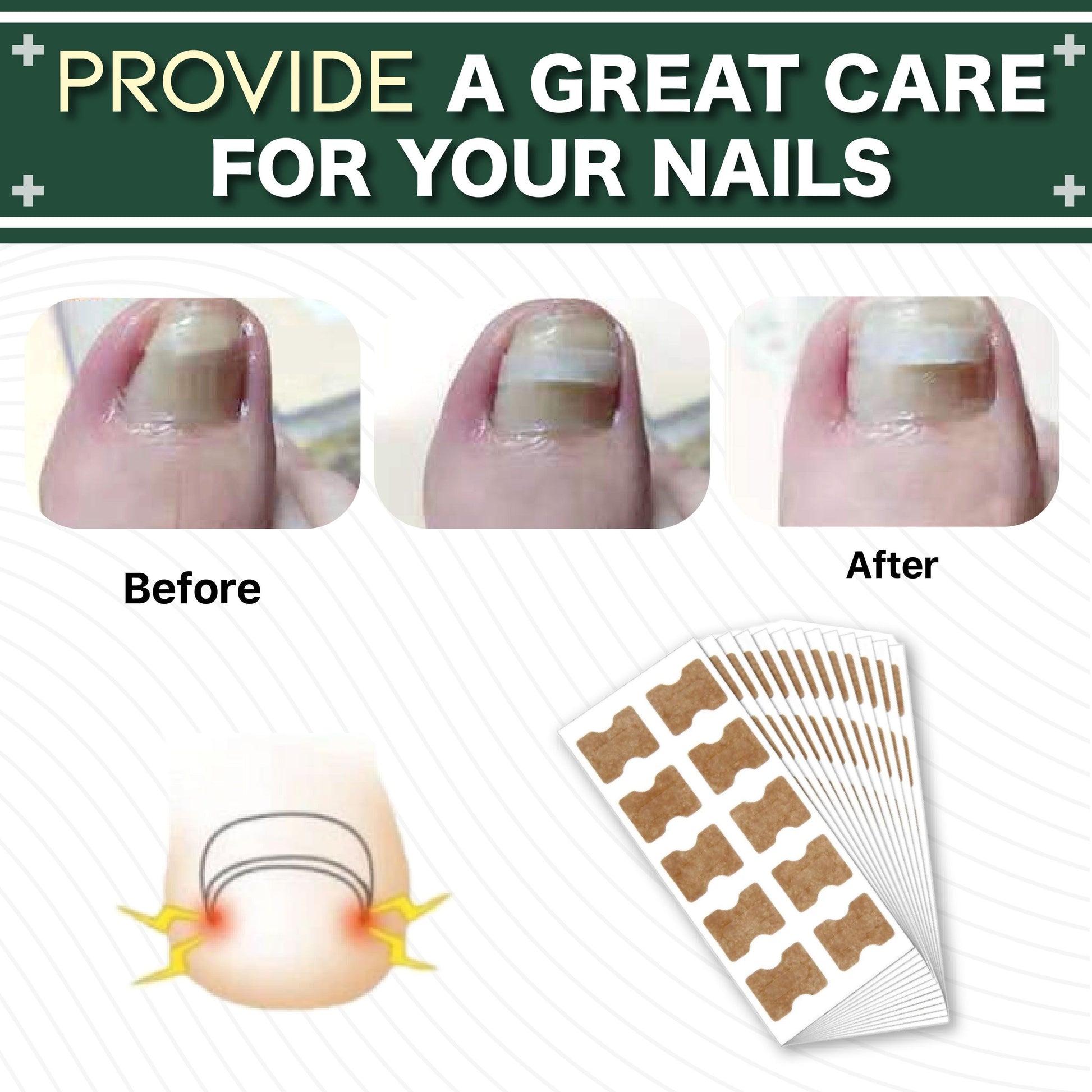 Toe Be Health Instant Beauty Patch(10pcs) 1668 